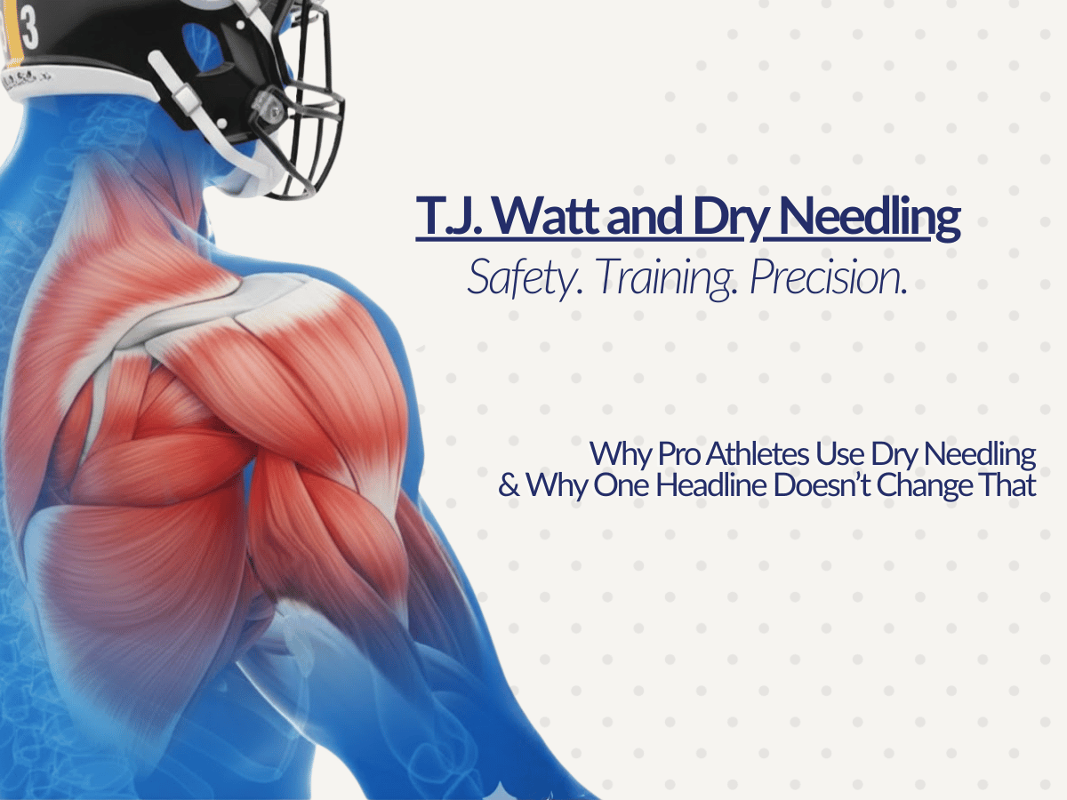 Illustration of a football player’s upper body showing shoulder and muscle anatomy, used to explain dry needling safety in physical therapy