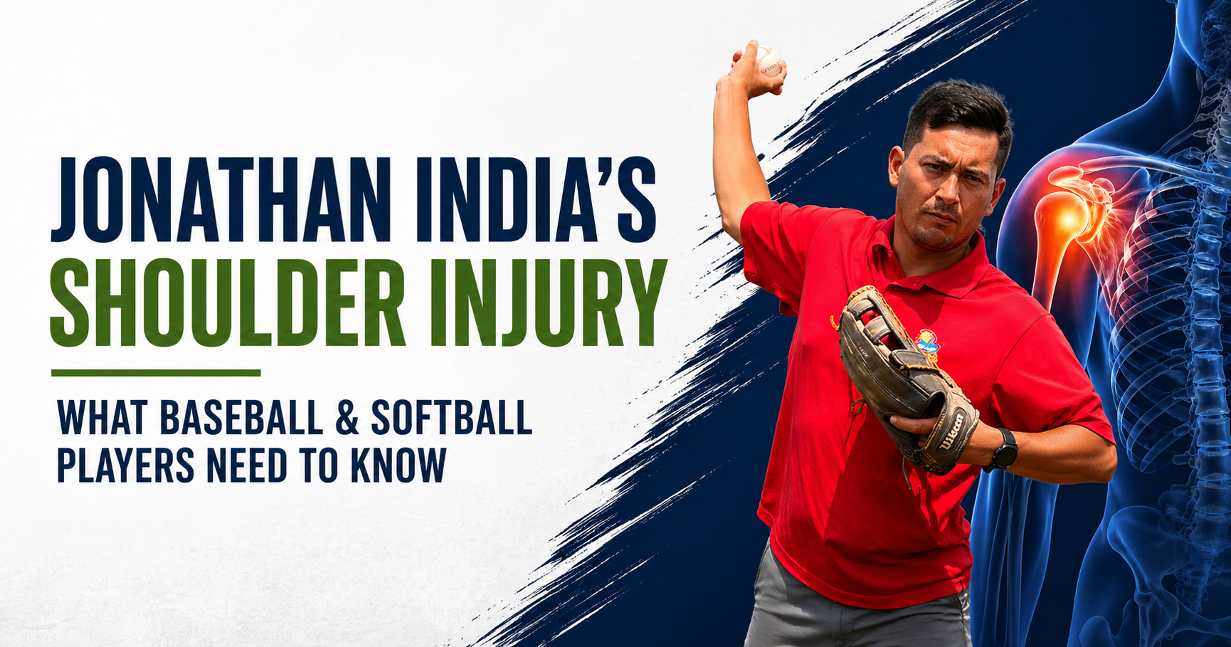 Baseball player demonstrating throwing motion with highlighted shoulder injury and labrum tear concept for youth athlete injury prevention